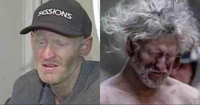Hiker Found Alive After 10 Days Lost In Mountains Shares Scary Survival Story