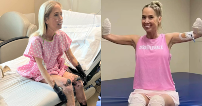 Woman Who Underwent Quadruple Amputation After Her Limbs &lsquo;Mummified&rsquo; Thought She Just Had A Cold