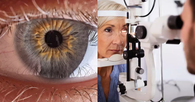 Scientists Discover A New, Ultra-Rare Eye Color Found In Just 1% Of People