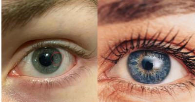 Woman Worried Her Boyfriend Is &lsquo;Factory Made&rsquo; After Spotting Weird Detail Inside His Eye