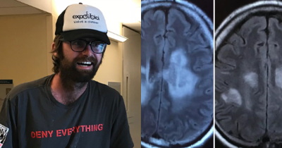 Man Who Suffered From Migraines Stunned To Discover He Actually Has Condition That Only 120 People Have Ever Had