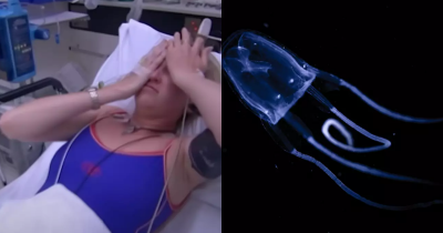 Victims Describe Stings From Mysterious 'Doom Jellyfish' Which Causes Pain So Intense People Ask To Die