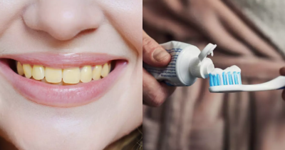 Dentist Says People Make Morning &lsquo;Mistake&rsquo; When Brushing Teeth That&rsquo;s Causing Them To Go Yellow