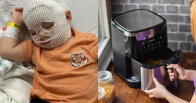 Mother Warns Others After 1-Year-Old Son Gets Severe Burns From Air Fryer