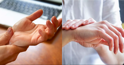 Doctor Shares Five Subtle Signs On Your Hands That Can Indicate Serious Health Problems