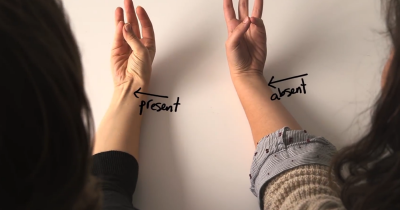 If A Tendon Pops Up When You Touch Your Thumb To Your Pinky, This Is What It Means