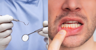 Dentist Gives Stark Warning Over Mistake That Can Worsen Disease Nearly Half Of People Suffer With