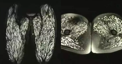Doctor Explains How Parasites Enter The Body After Horrifying Scans Of Infected Woman Emerge