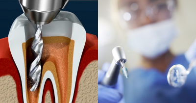 Detailed Root Canal Simulation Leaves Viewers 'Feeling The Pain' Just By Watching
