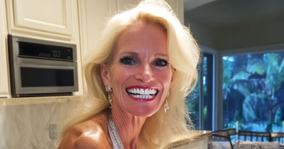 My Stepmom Took $5,000 From My College Fund For Veneers &mdash; But Karma Got The Last Laugh