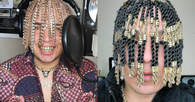 Rapper Faces Major Health Risks After Surgically Implanting Gold Chains Into His Head To Mimic Hair