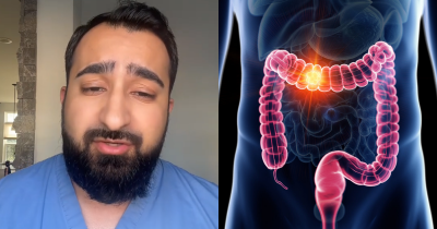 Doctor Explains 5 Concerning Symptoms That Could Signal Colon Cancer