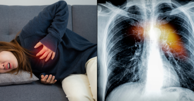 The Subtle Symptom Of Deadly Heart Failure You Might Spot In Bed