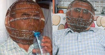 Man Determined To Quit Smoking Locks His Head In A Cage, Giving Wife The Only Key