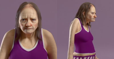 Doctor Shares Alarming Images Showing The Effects Of Six Hours Of Sleep On The Body