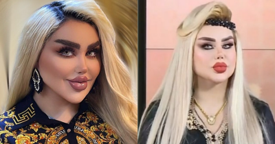 Baghdad Woman Undergoes 43 Procedures To Resemble Barbie, Faces Harsh Criticism
