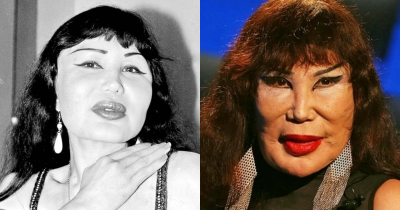 Lyn May's Tragic Journey Through Fame And Cosmetic Surgery