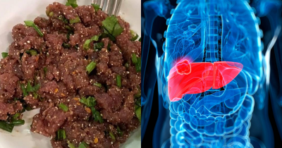 Deadly Thai Dish Linked To Cancer Risks Millions Still Ignore