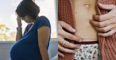 Woman Performed Her Own C-Section With A Kitchen Knife And No Medical Training