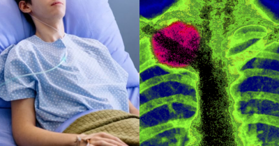 Teen Boy Initially Told He Pulled A Muscle, Later Diagnosed With Rare Terminal Cancer