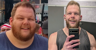 Man Receives Overwhelming Support After Losing An Incredible 336lbs
