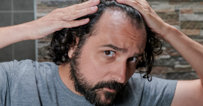 Doctor Warns That A Popular Drink May Lead To Hair Loss &ndash; And How To Prevent It
