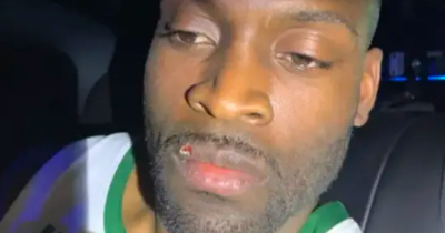 Police Forced To X-Ray Suspect&rsquo;s Stomach After Alleged Jewelry Heist Involving $769,000 Diamond Earrings