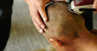 Dad Shaves Daughter&rsquo;s Head After She Bullies Cancer Patient And Pulls Off Her Wig