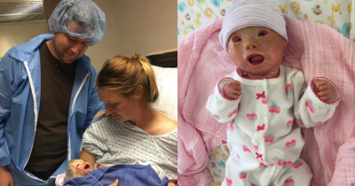 Doctors Perform Emergency Caesarean Section, Then Dad Sees Baby's Face