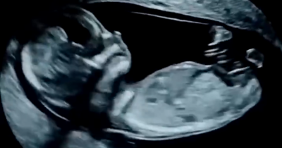 Amazing Footage Reveals What Babies Really Do In The Womb &mdash; And It's Blowing People's Minds