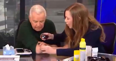 Shocking Moment TV Host Learns He Has Skin Cancer Live On-Air From Dermatologist