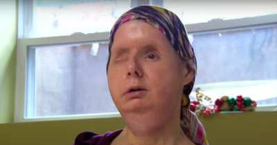 Woman Mauled By Friend's Pet Chimp Shares Chilling Details Of The Terrifying Sound She Heard