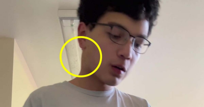 Student Says TikTok Helped Catch Serious Illness After Spotting Odd Symptom In Trend Video