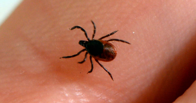 Doctor Warns About Overlooked Signs Of Lyme Disease As Tick Bites Surge Across US