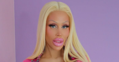 Before-And-After Pics Reveal What Woman Who Spent $335k To Become Barbie Really Looked Like