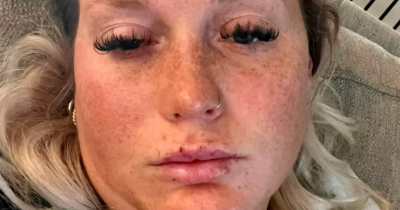 Woman Shares Chilling Warning After Beauty Procedure Leaves Her 'Partially Paralyzed'