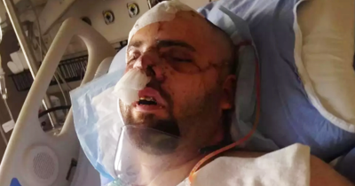 Bear Attack Survivor Left Chilling Farewell Note To Wife After Collecting Pieces Of His Own Flesh