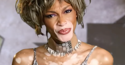 Winnie Harlow Criticized By Whitney Houston Fans For 'Disrespectful' Halloween Costume