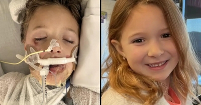 Girl, 7, Placed In Coma After Copying Dangerous Squishy Toy Trend From Social Media