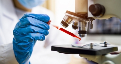 Symptoms Of AIDs Explained As Experts Warn Of 3.3 Million New HIV Cases