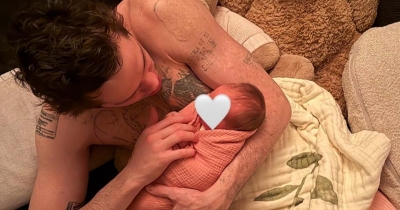 Pete Davidson's Girlfriend Shows Off His New Look After He Spent $200,000 'Burning Off' Almost 200 Tattoos