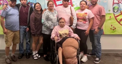 Florida Teen Undergoes 17-Hour Surgery To Amputate 170-Pound Leg Caused By Ultra-Rare Condition That Baffled Doctors