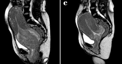 Woman Gives Birth Inside MRI Scanner In Unprecedented Attempt To Reveal How Childbirth Works
