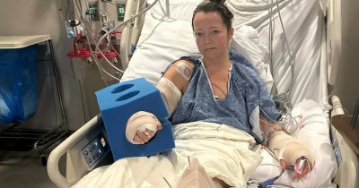Mom Loses Leg After Attack By Her Own Pet Pit Bull Left Limb 'Basically Hanging Off'