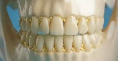 Horrifying Simulation Claims To Show What Could Happen To Your Teeth If You Skipped Brushing For 30 Days