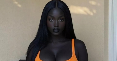 The Shocking Truth Behind The Influencer Dubbed 'The World's Most Beautiful Girl'