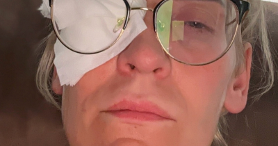 Woman Lost Her Sight After Making A Serious Mistake While Wearing Contact Lenses