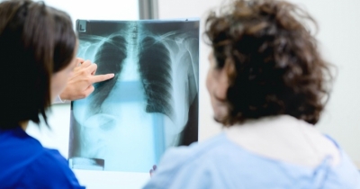 Simple At-Home 'Finger Test' May Help Spot Early Warning Signs Of Lung Cancer