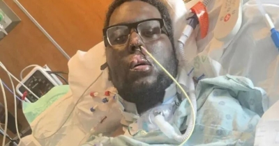 Dad, 34, Falls Into Coma And Loses All Four Limbs After Routine Dentist Visit