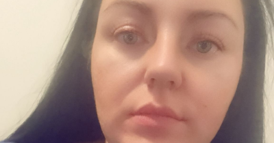Woman Shares Bizarre Side Effects From Weight-Loss Drug After Her Tongue Turned Black